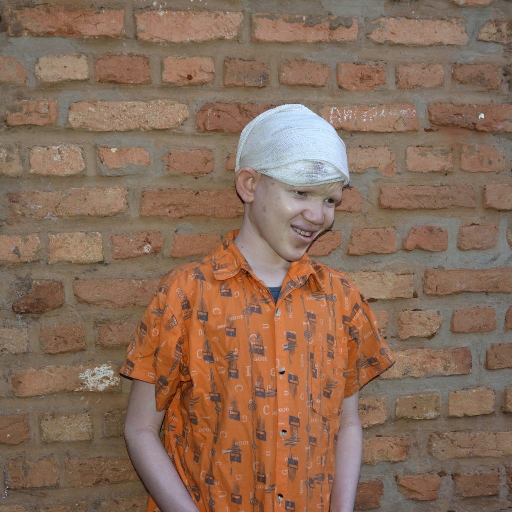 Oeg.14.albinos' 3